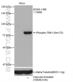 Phospho-TBK1 (Ser172) Rabbit Recombinant Antibody, Proteintech 20 &mu;L | Buy Online | Proteintech | Fisher Scientific