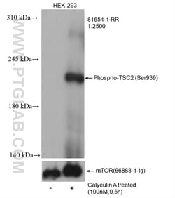 Phospho-TSC2 (Ser939) Rabbit Recombinant Antibody, Proteintech Unconjugated;