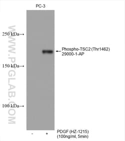 Phospho-TSC2 (Thr1462) Rabbit Polyclonal Antibody, Proteintech Unconjugated;