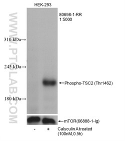 Phospho-TSC2 (Thr1462) Rabbit Recombinant Antibody, Proteintech 100 &mu;L | Buy Online | Proteintech | Fisher Scientific