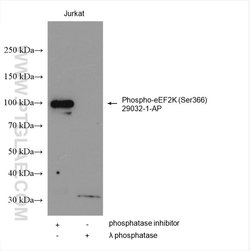 Phospho-eEF2K (Ser366) Rabbit anti-Human, Polyclonal, Proteintech 20 &mu;L | Buy Online | Proteintech | Fisher Scientific