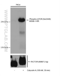 Phospho-mTOR (Ser2448) Rabbit Recombinant Antibody, Proteintech:Antibodies:Primary
