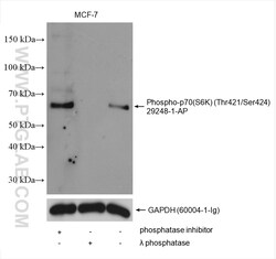 Phospho-p70(S6K) (Thr421/Ser424) Rabbit Polyclonal Antibody, Proteintech:Antibodies:Primary