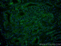 CoraLite Plus 488-conjugated Prostein Mouse Monoclonal Antibody, Proteintech:Antibodies:Primary