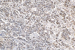 QRICH1 Rabbit Polyclonal Antibody, Proteintech 150 &mu;L | Buy Online | Proteintech | Fisher Scientific