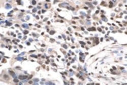 QRICH1 Rabbit Polyclonal Antibody, Proteintech 150 &mu;L | Buy Online | Proteintech | Fisher Scientific