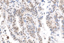 QRICH1 Rabbit Polyclonal Antibody, Proteintech 150 &mu;L | Buy Online | Proteintech | Fisher Scientific
