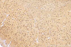 QRICH1 Rabbit Polyclonal Antibody, Proteintech 150 &mu;L | Buy Online | Proteintech | Fisher Scientific