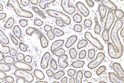 QRICH1 Rabbit Polyclonal Antibody, Proteintech 150 &mu;L | Buy Online | Proteintech | Fisher Scientific