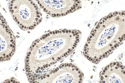 QRICH1 Rabbit Polyclonal Antibody, Proteintech 150 &mu;L | Buy Online | Proteintech | Fisher Scientific