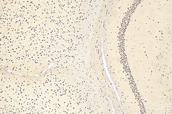 QRICH1 Rabbit Polyclonal Antibody, Proteintech 150 &mu;L | Buy Online | Proteintech | Fisher Scientific