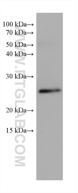 RAB11A Mouse Monoclonal Antibody, Proteintech Unconjugated; 20 &mu;L:Antibodies,