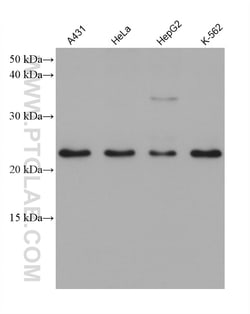 RAB11A Mouse Monoclonal Antibody, Proteintech Unconjugated; 20 &mu;L:Antibodies,