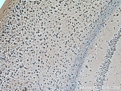 RAB18 Mouse Monoclonal Antibody, Proteintech:Antibodies:Primary Antibodies