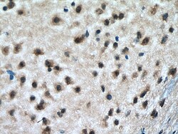 RAB18 Mouse Monoclonal Antibody, Proteintech:Antibodies:Primary Antibodies