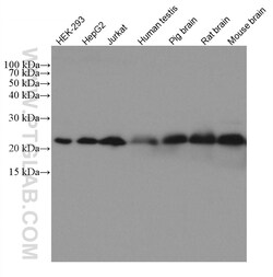 RAB18 Mouse Monoclonal Antibody, Proteintech:Antibodies:Primary Antibodies