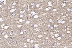 RAB3A Mouse Monoclonal Antibody, Proteintech Unconjugated; 150 &mu;L:Antibodies,