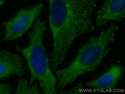 RABEP1 Mouse Monoclonal Antibody, Proteintech Unconjugated; 150 &mu;L:Antibodies,