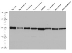 RABEP1 Mouse Monoclonal Antibody, Proteintech Unconjugated; 150 &mu;L:Antibodies,