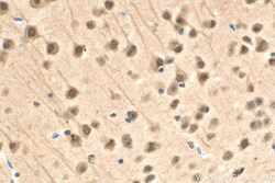RAD23B Mouse Monoclonal Antibody, Proteintech Unconjugated; 20 &mu;L:Antibodies,
