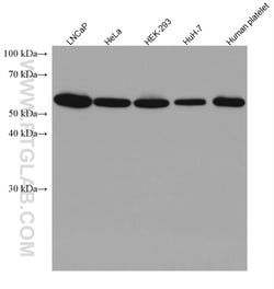 RAD23B Mouse Monoclonal Antibody, Proteintech Unconjugated; 20 &mu;L:Antibodies,