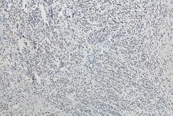 RALY Mouse Monoclonal Antibody, Proteintech Unconjugated; 20 &mu;L:Antibodies,