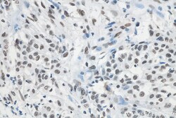 RALY Mouse Monoclonal Antibody, Proteintech Unconjugated; 20 &mu;L:Antibodies,