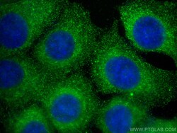 RAP2A Mouse Monoclonal Antibody, Proteintech Unconjugated; 20 &mu;L:Antibodies,