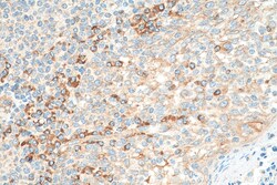 RASGRF2 Rabbit Polyclonal Antibody, Proteintech Unconjugated; 150 &mu;L:Antibodies,