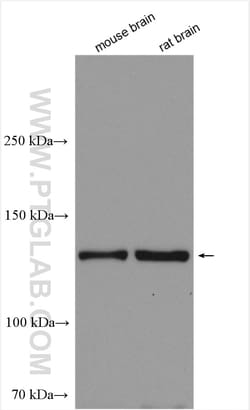 RASGRF2 Rabbit Polyclonal Antibody, Proteintech Unconjugated; 150 &mu;L:Antibodies,