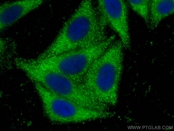 RBP5 Mouse Monoclonal Antibody, Proteintech Unconjugated; 150 &mu;L:Antibodies,