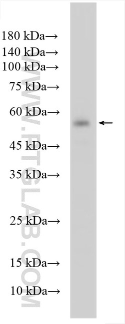 RBPJ Rabbit Polyclonal Antibody, Proteintech Unconjugated; 150 &mu;L:Antibodies,