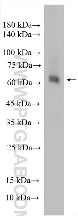 RBPJ Rabbit Polyclonal Antibody, Proteintech Unconjugated; 150 &mu;L:Antibodies,