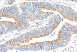 REEP5 Mouse Monoclonal Antibody, Proteintech Unconjugated; 20 &mu;L:Antibodies,
