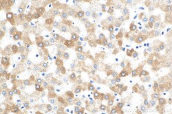 REEP5 Mouse Monoclonal Antibody, Proteintech Unconjugated; 20 &mu;L:Antibodies,