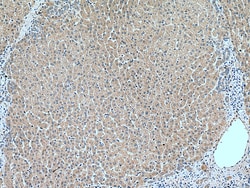 RETN Rabbit Polyclonal Antibody, Proteintech Unconjugated; 20 &mu;L:Antibodies,