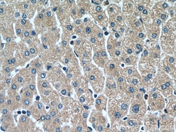 RETN Rabbit Polyclonal Antibody, Proteintech Unconjugated; 20 &mu;L:Antibodies,