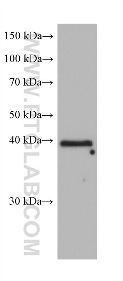 RFC3 Mouse Monoclonal Antibody, Proteintech Unconjugated; 20 &mu;L:Antibodies,