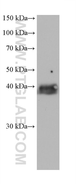 RFC3 Mouse Monoclonal Antibody, Proteintech Unconjugated; 20 &mu;L:Antibodies,