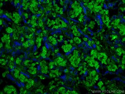 RHAG Mouse Monoclonal Antibody, Proteintech Unconjugated; 150 &mu;L:Anticorps,