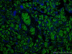 RHAG Mouse Monoclonal Antibody, Proteintech Unconjugated; 150 &mu;L:Anticorps,
