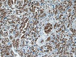 RHAG Mouse Monoclonal Antibody, Proteintech Unconjugated; 150 &mu;L:Anticorps,