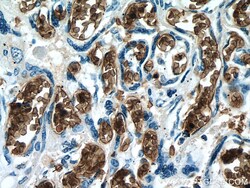 RHAG Mouse Monoclonal Antibody, Proteintech Unconjugated; 150 &mu;L:Anticorps,
