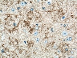 ARHGAP32 Rabbit Polyclonal Antibody, Proteintech Unconjugated; 20 &mu;L:Antibodies,