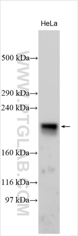 ARHGAP32 Rabbit Polyclonal Antibody, Proteintech Unconjugated; 20 &mu;L:Antibodies,