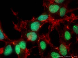 RIF1 Rabbit Polyclonal Antibody, Proteintech:Anticuerpos:Anticuerpos primarios