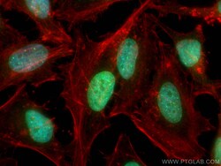 RIF1 Rabbit Polyclonal Antibody, Proteintech:Anticuerpos:Anticuerpos primarios