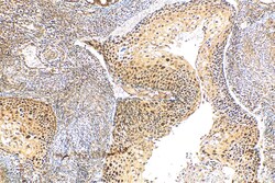 RIF1 Rabbit Polyclonal Antibody, Proteintech:Anticuerpos:Anticuerpos primarios