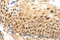 RIF1 Rabbit Polyclonal Antibody, Proteintech:Anticuerpos:Anticuerpos primarios