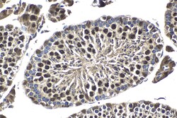 RIF1 Rabbit Polyclonal Antibody, Proteintech:Anticuerpos:Anticuerpos primarios